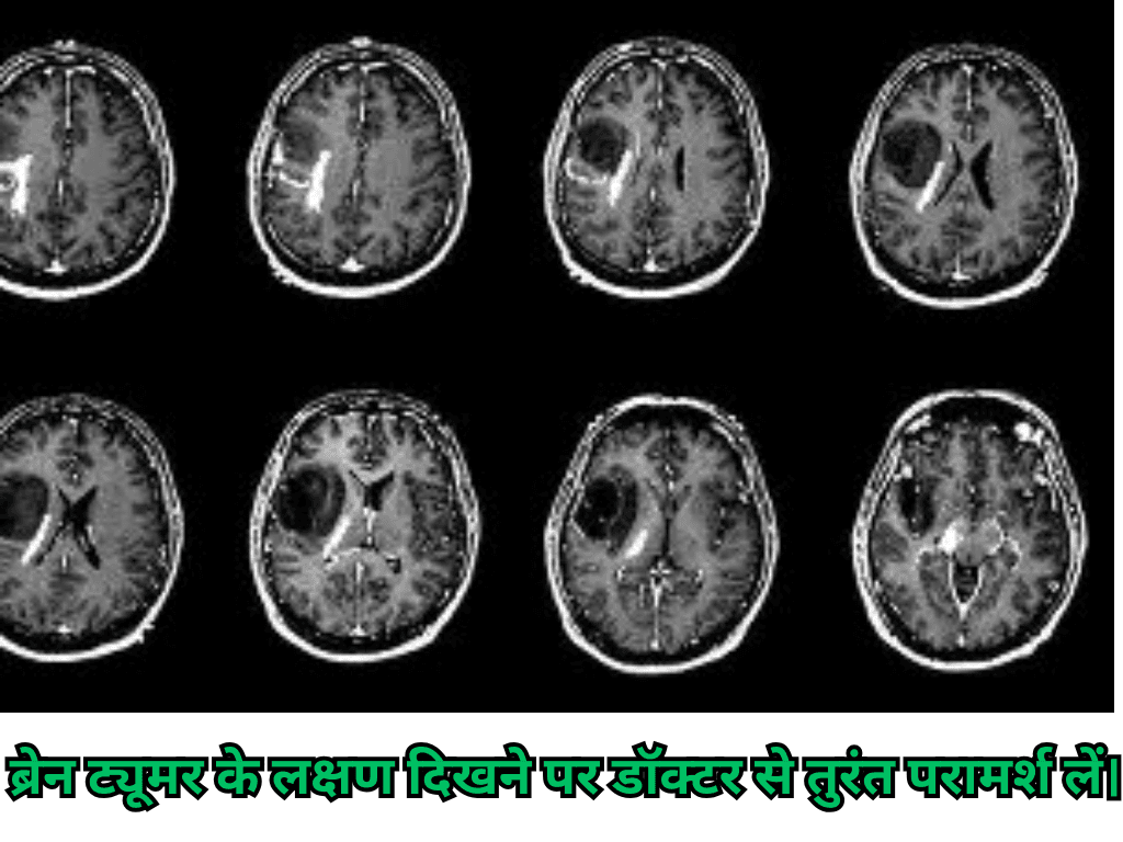 World Brain Tumor Day