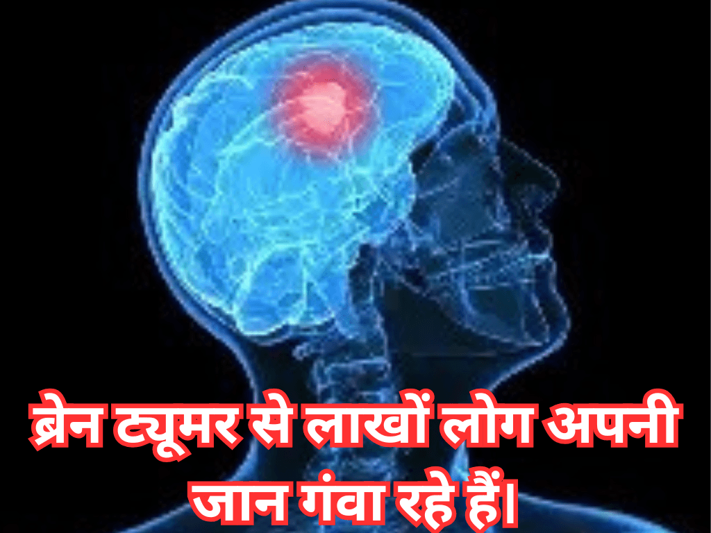 World Brain Tumor Day