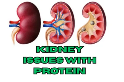 Kidney Issues with Protein