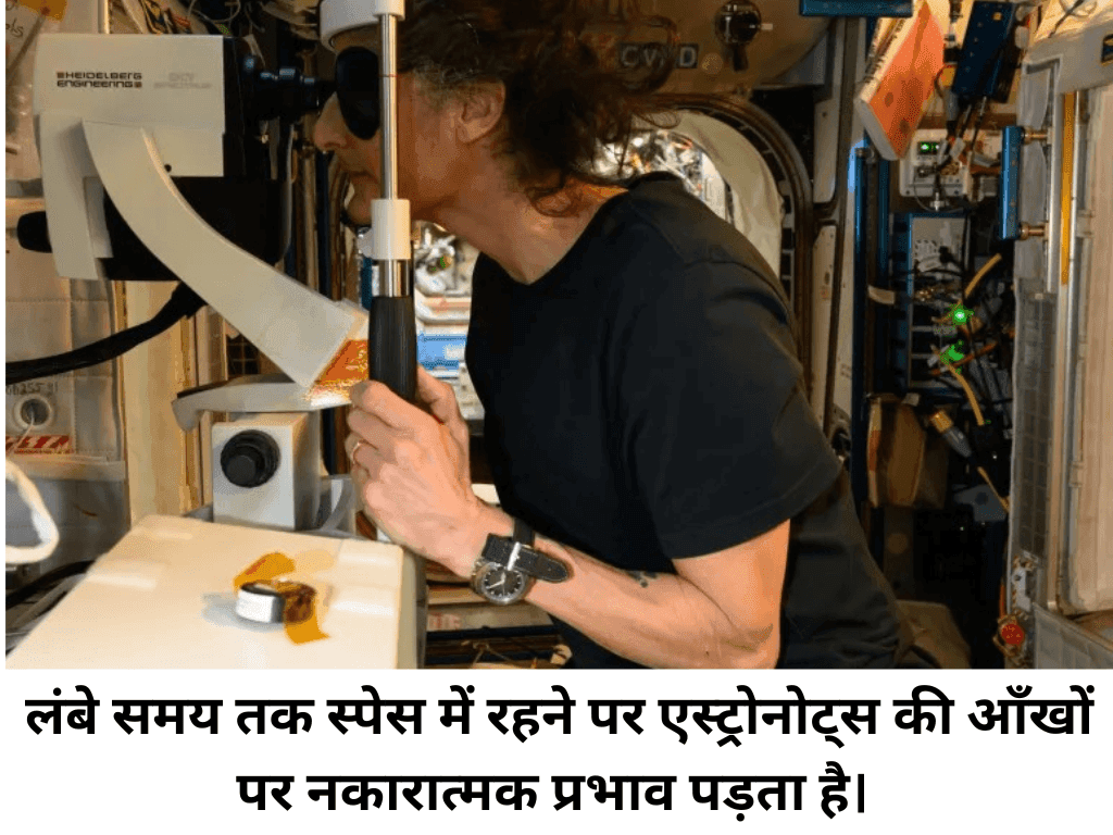 Vision Problem in Astronauts