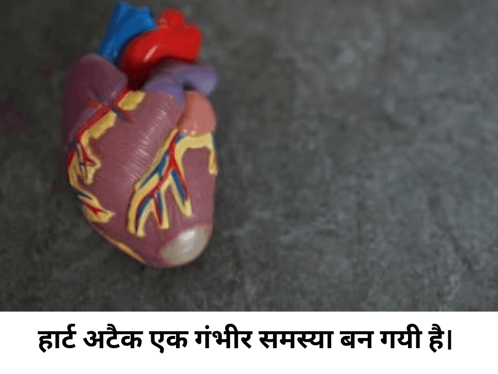 Heart attack symptoms