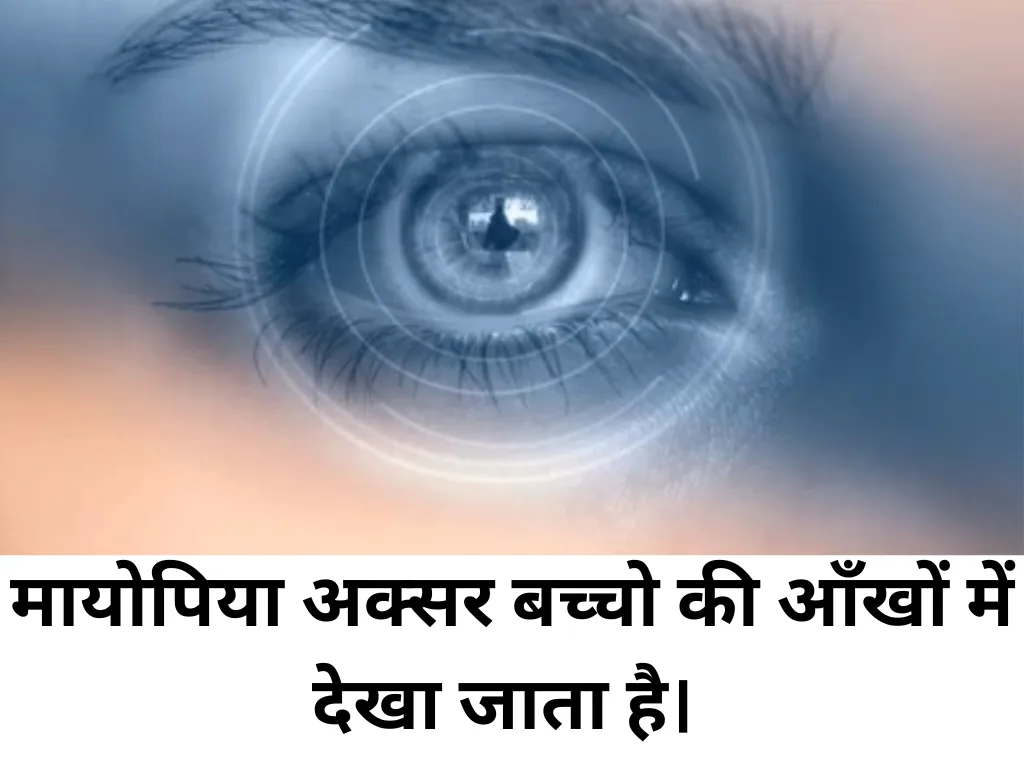 Myopia Signs and Symptoms