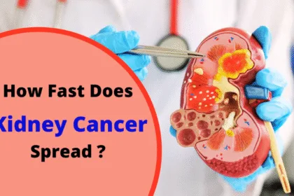 Kidney Cancer Cases to Double By 2050