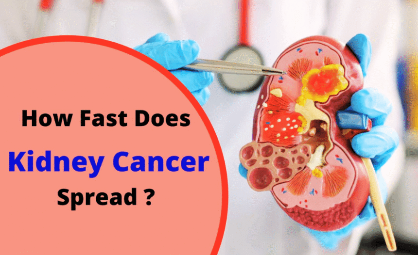 Kidney Cancer Cases to Double By 2050